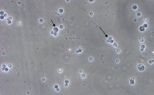 酵母双杂交技术原理、试验流程、特点以及应用