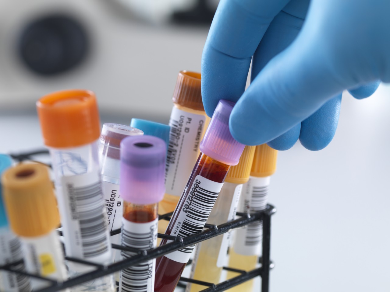 “溶出”还是“BE”，何为临床疗效“金标准”