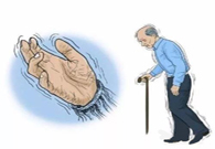 帕金森。芭痢辈慌拢