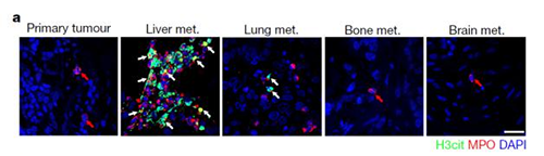 转入小鼠模型得到相同的试验结果，且在转移发生前NET已在肝脏聚积。