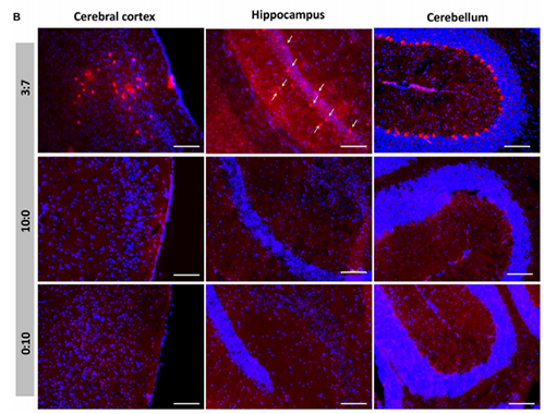 被包裹在含有NT-类脂质的LNP中的Cre重组酶成功转移。大脑中的转染神经元呈红色高亮。