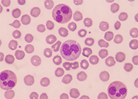 一种神秘颗粒被发现了！它能否成为败血症早筛标志物？