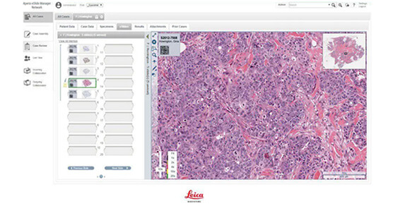 Leica--eSlide分析管理软件