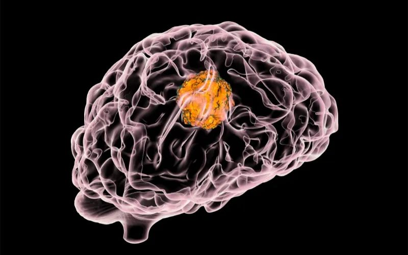 不朽情缘mg官网助力 | 璧辰医药ABM-1310获美国FDA孤儿药资格认证，用于治疗携带BRAF V600突变的脑胶质母细胞瘤患者